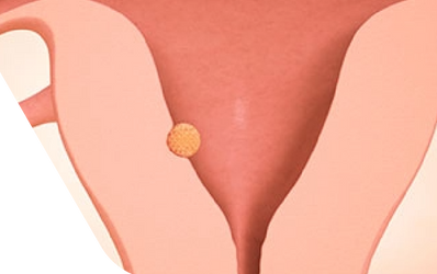 Enceinte de quatre semaines