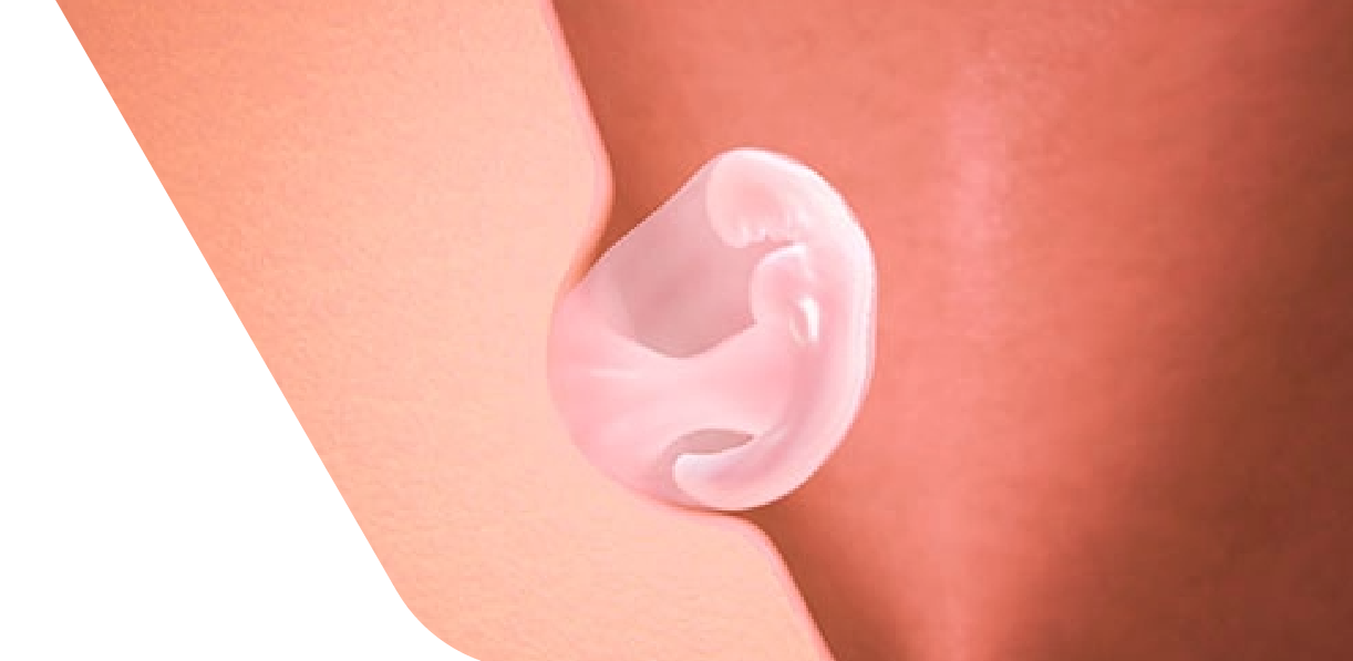5 Weeks Pregnant