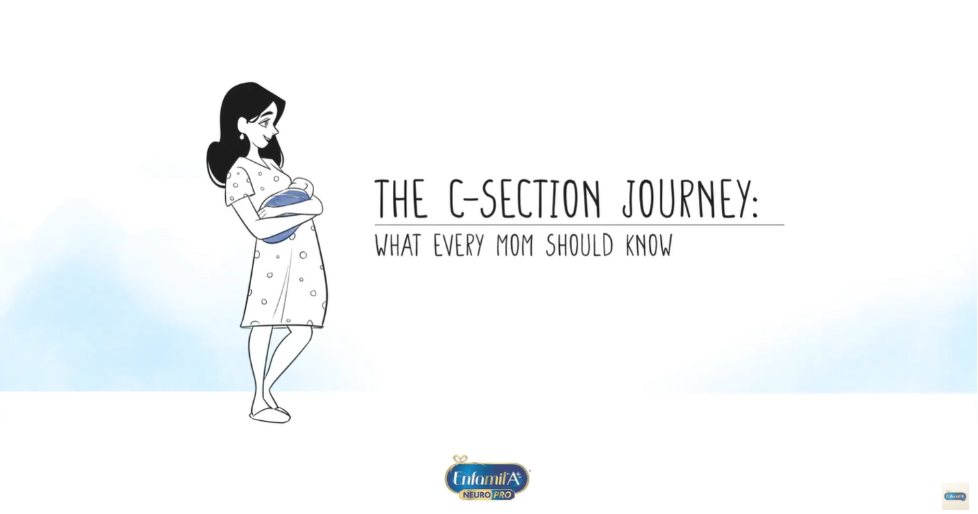 Load video: The C-Section Journey - What Every Mom Should Know